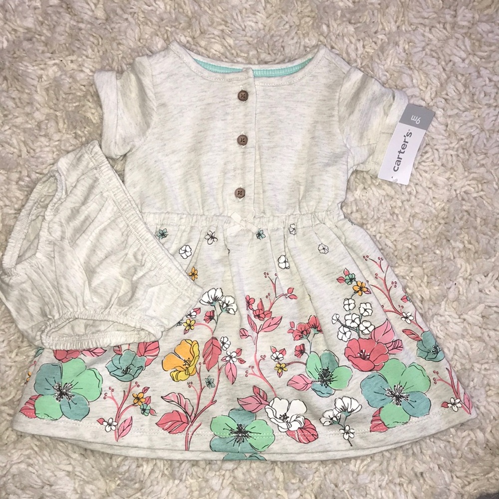 Baby dress casual
